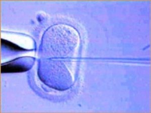 NOVA Odcinek 2