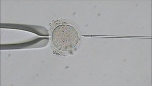 NOVA Odcinek 8
