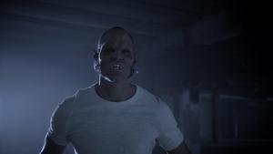 Teen Wolf: Nastoletni wilkołak Ranny